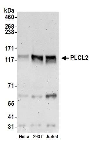 Polyclonal Rabbit anti-Human PLCL2 Antibody (aa1077-1127, WB)