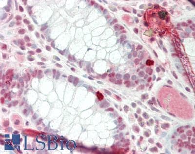 Polyclonal Rabbit anti-Human MINA / MINA53 Antibody (aa374-423, IHC)