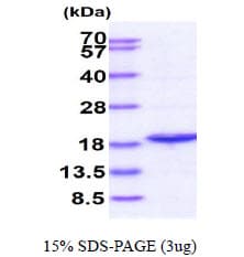 Human PPIL1 Protein (Recombinant His)