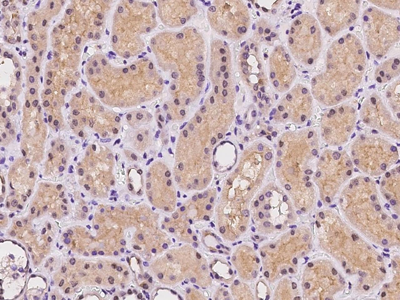 PTPRJ / CD148 Antibody