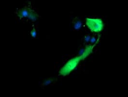 ANAPC11 / APC11 Antibody (clone OTI1B5)