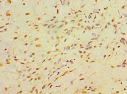 CA14 / Carbonic Anhydrase XIV Antibody
