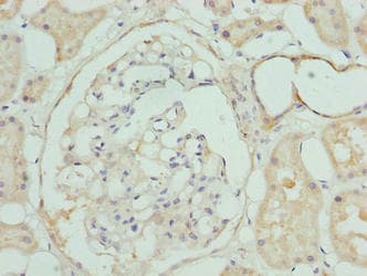 Polyclonal Rabbit anti-Human CLYBL Antibody (IHC, WB)