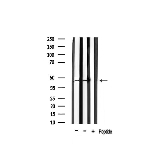 Polyclonal Rabbit anti-Human F2R / Thrombin Receptor / PAR1 Antibody (IF, WB)