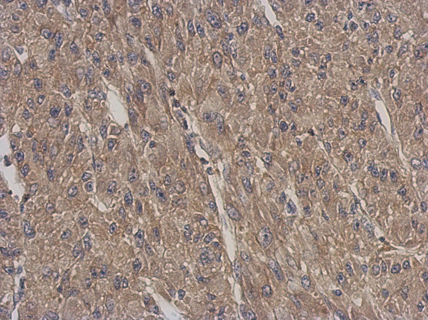 Polyclonal Rabbit anti-Human ARPC5L Antibody (IHC, WB)