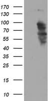Monoclonal Mouse anti-Human SOX5 Antibody (clone OTI2A8, WB)