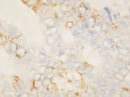 BCL2L1 / BCL-XL Antibody (Internal)