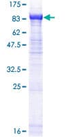Human ASNSD1 Protein (Recombinant GST)