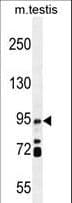 IHC-plus™ TG737 / IFT88 Antibody (aa791-820)