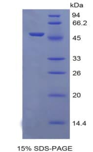 Rat ERBB2 / HER2 Protein (Recombinant His-GST)