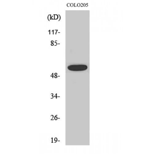 AKT1 Antibody (240-320 aa)