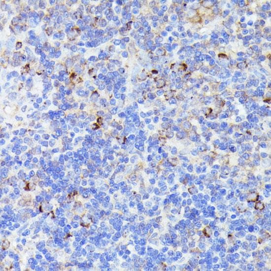 CCDC6 Antibody