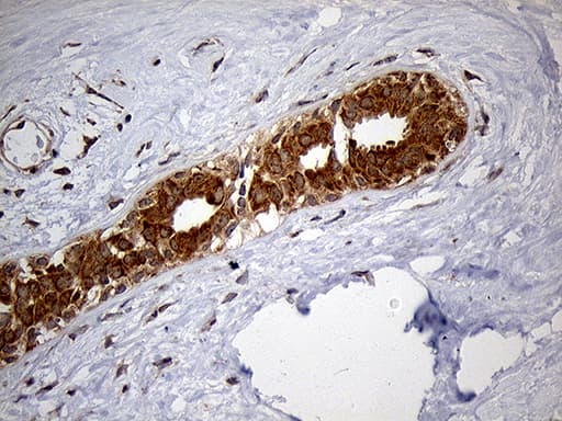 HDHD3 Antibody (clone OTI1C5, Carrier-free)