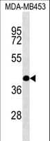 Polyclonal Rabbit anti-Human SHF Antibody (aa384-411, WB)