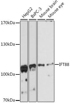 Polyclonal Rabbit anti-Human TG737 / IFT88 Antibody (IF, WB)