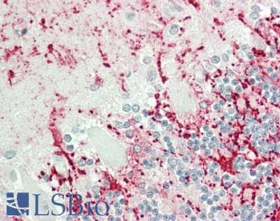 IHC-plus™ Polyclonal Rabbit anti-Human CREM / ICER Antibody (Internal, IHC, WB)