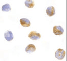 Polyclonal Rabbit anti-Human CARD9 Antibody (aa521-536, WB)