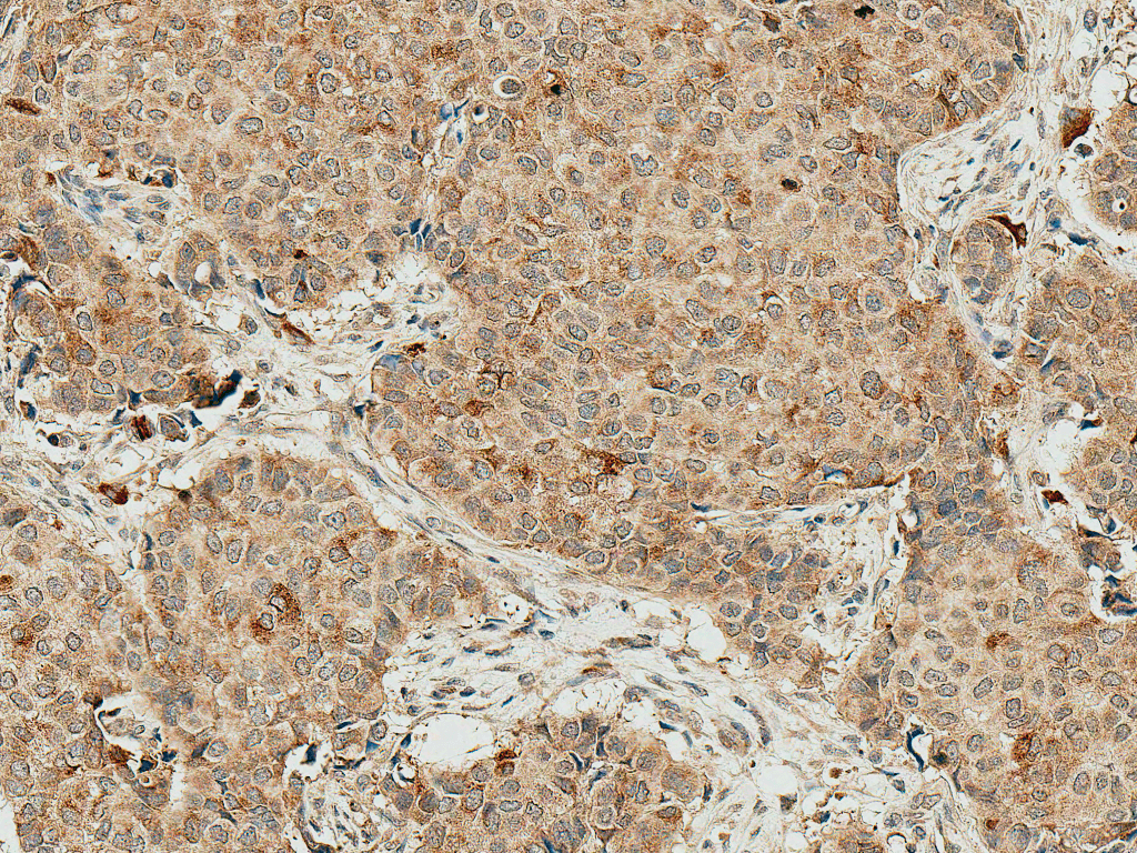 SMAD4 Antibody (FITC)