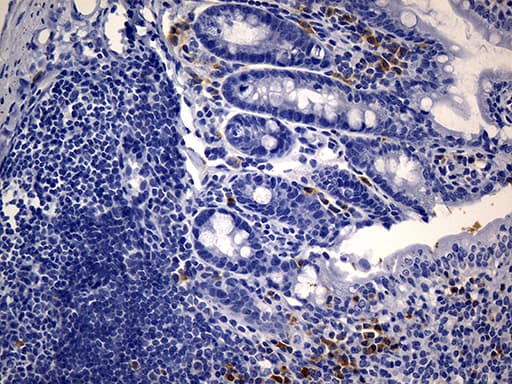 Monoclonal Mouse anti-Human CD74 / CLIP Antibody (clone UMAB232, IHC, WB)