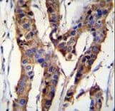 ZBTB24 / BIF1 Antibody (aa137-166)
