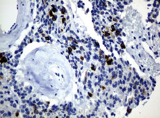 KRT19 / CK19 / Cytokeratin 19 Antibody (aa240-390, clone UMAB3, Carrier-free)