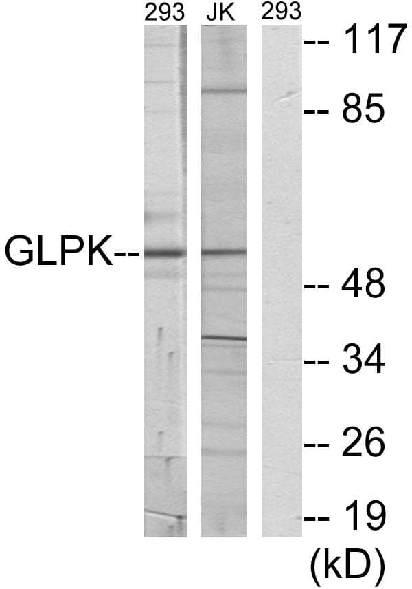 GK / Glycerol Kinase Antibody