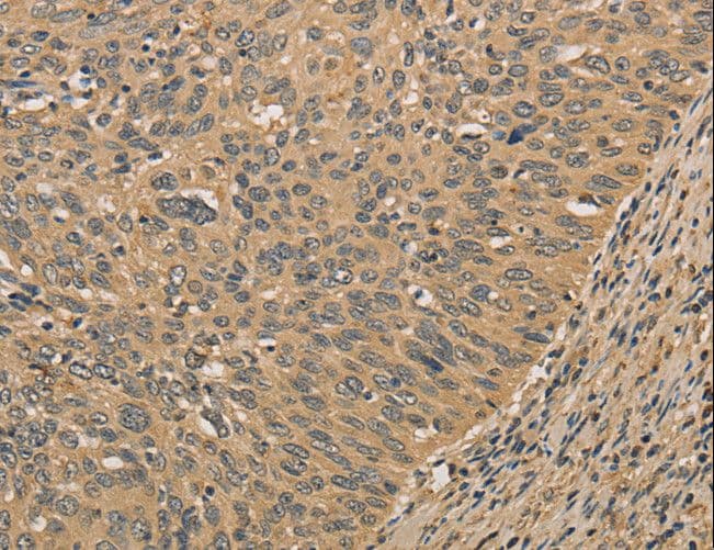 Polyclonal Rabbit anti-Human PRDM14 Antibody (IHC)