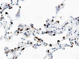 AK5 / Adenylate Kinase 5 Antibody (clone OTI2F9)