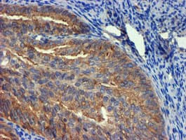 TUBAL3 Antibody (aa150-446, clone OTI4D9, Carrier-free)