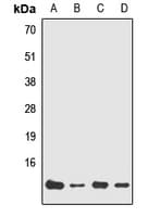 NDUFA7 Antibody