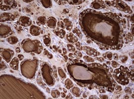 TG / Thyroglobulin Antibody (aa2511-2768, clone OTI3E12)
