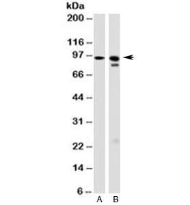 HSP90B1 / GP96 / GRP94 Antibody (clone 9G10.F8.2)