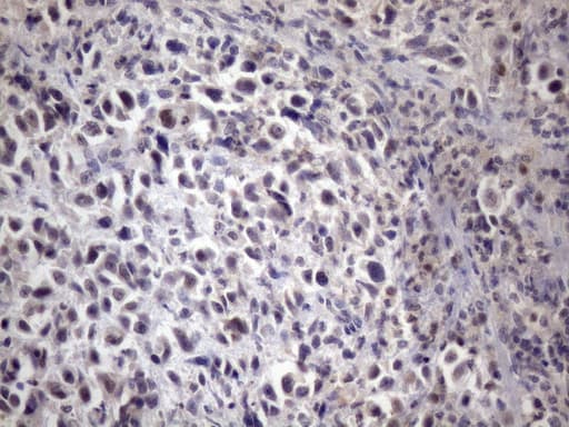 Monoclonal Mouse anti-Human XRCC6BP1 Antibody (clone OTI5F3, IHC, WB)