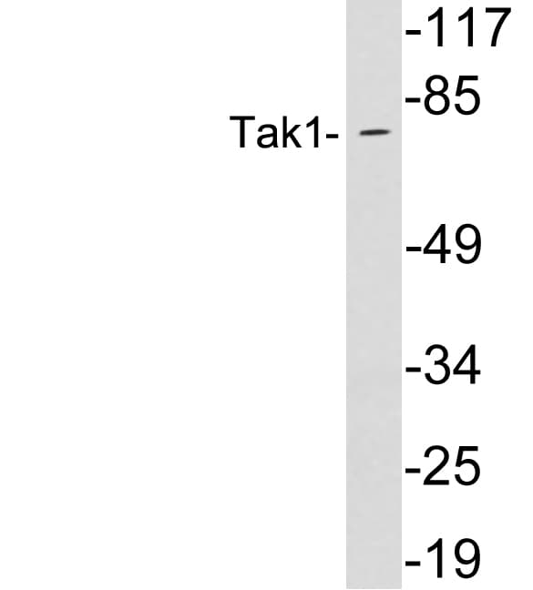 MAP3K7 / TAK1 Antibody (aa138-187)