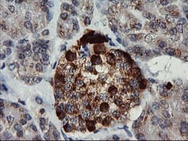 CHGA / Chromogranin A Antibody (clone OTI2E12)
