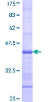 Human TRIM47 Protein (Recombinant GST, N-terminus)