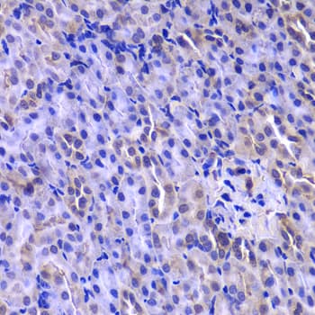 Thymidylate Kinase Antibody