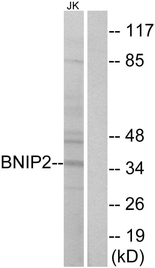 BNIP2 Antibody