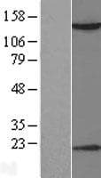 Human HDAC6 Protein (Over-Expression Lysate Myc-DDK (Flag))
