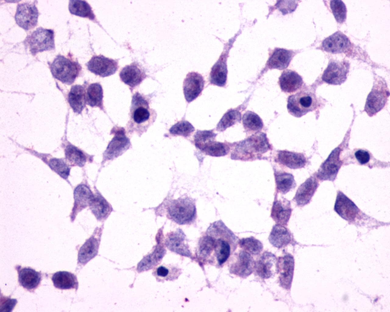 PathPlus™ GRM2 / MGLUR2 Antibody (N-Terminus)