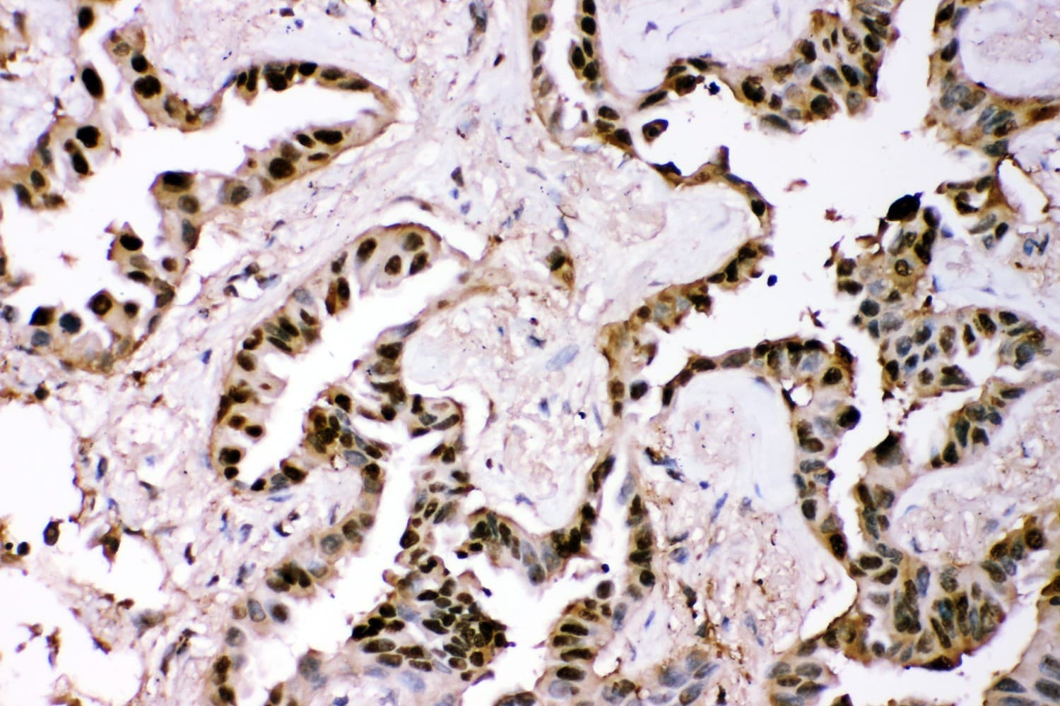 GSTP1 / GST Pi Antibody (aa2-210)