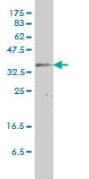 Monoclonal Mouse anti-Human GJB3 / CX31 / Connexin 31 Antibody (clone 3B4-1B3, IF, WB)