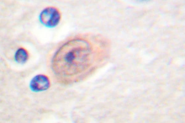 CSE1L Antibody (Glu2)