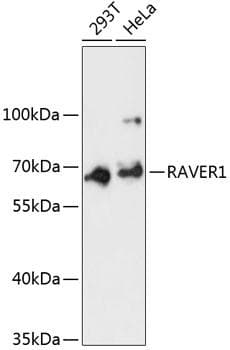 Polyclonal Rabbit anti-Human RAVER1 Antibody (WB)
