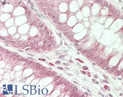 IHC-plus™ CDK13 / CDC2L5 Antibody
