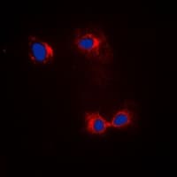 Monoclonal Mouse anti-Human ACTB / Beta Actin Antibody (IHC, IF, WB)