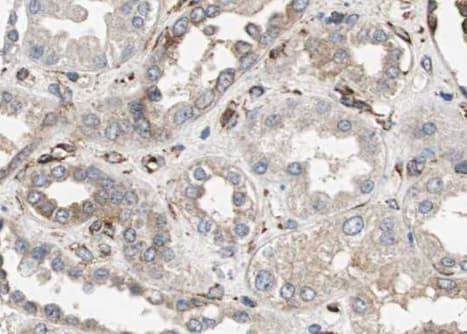 PPP1R15A / GADD34 Antibody