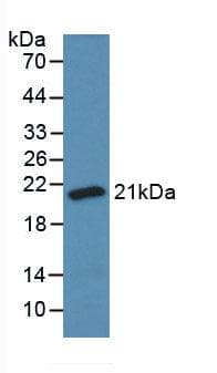 SOD1 / Cu-Zn SOD Antibody (aa2-152)