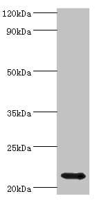 Polyclonal Rabbit anti-Human HSPB8 / H11 / HSP22 Antibody (aa1-196, WB)