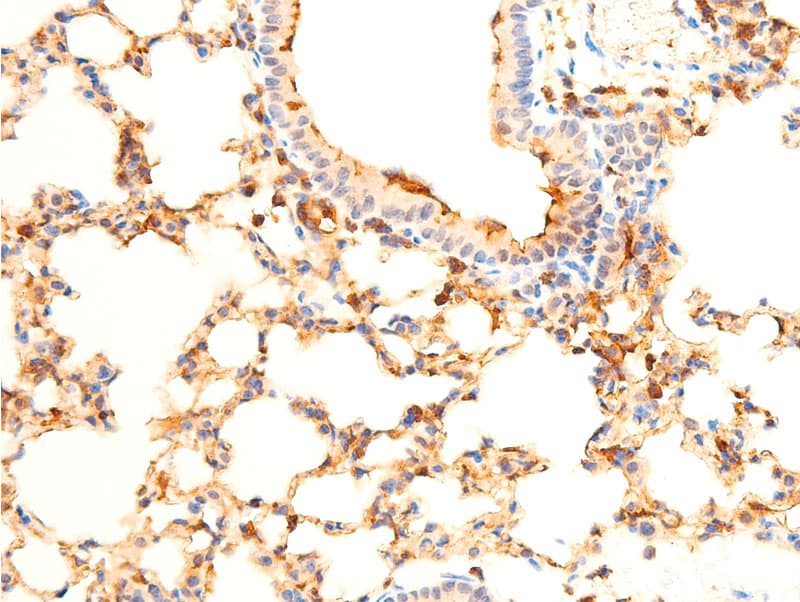 Polyclonal Rabbit anti-Human SYK Antibody (phospho-Tyr323, IHC, IF, WB)
